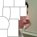 Profile view(Pre- Op)