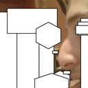 Profile View(Pre- Op)