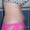 14 weeks 2 days PO