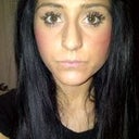Frontal Before- Wide nose