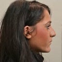 Side Before- Beak Nose