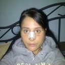Recovery- 3 days after surgery