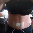 This a a little closerlook at tummy day 2