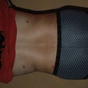 Day 3 Post Op Back