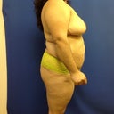 Side View Pre-
