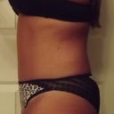 left side 13wks