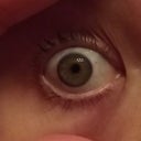 right eye after lasik 5/1/13