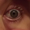 left eye after lasik.....see the blood spots...apparently its normal,it's from the suction :/