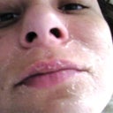 1st time peel. some of the peel got on my lips, as you can see they are peeling too.