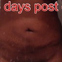 If there was a sideview u could tell the pain went away