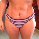 Can see the swelling today.