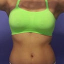 9 Day Post Op - Super comfy Hanes Bandini!