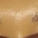 Two months post permanent eyebrow tattoos. The color has faded so much that I had to start drawing them in again with brow powder.