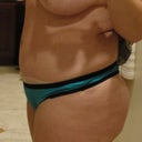 6 weeks post op