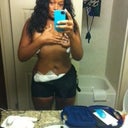 3 days after surgery