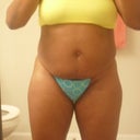 Pre-Op:  6/29/12 (2 days 'til the BIG day!)