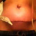 swelling big time