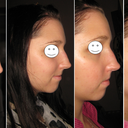 Before, Same Day, Day 1, Day 2