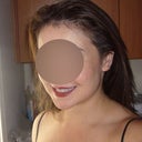 Before implant