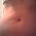 Eight days post-procedure