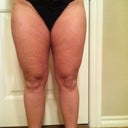 inner thigh before