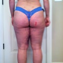 day 3 back view