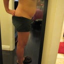 4 days before surgery - side view