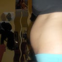 before smart lipo