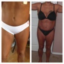 My before and after of lipo.....lipo of upper abdomen,flanks,and stomach,inner thighs
