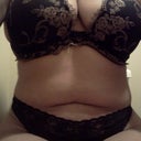 8 week post op