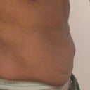 Side view - 1 day before TT