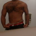 Standing, 1 Wk Post TT