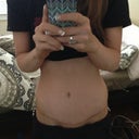 scar at 20 weeks. Still very visible but I know it will fade!