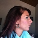 Another side profile shot, same day, cast removal day.