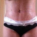 after 9 days :)