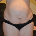 the day before operation