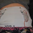 Week 1 after the operation. Sore and cant move much.