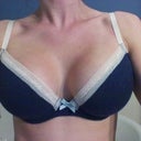 1 month after surgery