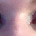 Morning after looks bad but no pain at all