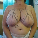 Surgeons notes, 15 minutes to go.