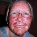 29 hours after deep fx