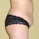 side view undies under belly