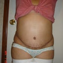 3 weeks 2 days post front
Really swollen... Was really ACTIVE today
Got My Period today so I could also be Bloated