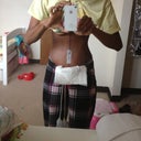 Post Op Day 4 - Still very swollen. Can't wait to see what it will look like once the swelling goes away!