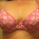 2 1/2 mo Post Op
My very first polka dotted bra!!
