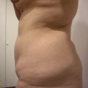 Before, torso profile