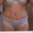 7 weeks post-op