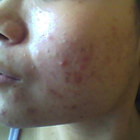 this is me at 27/12/12. Will upload again at 3/1/13