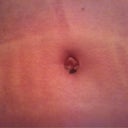 PO day 19. Close up of bb. Just a little area of scabbing left.