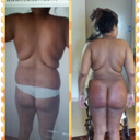 4 days post opt